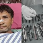 29 spoons, 19 toothbrushes, 2 pens pulled out of patient’s stomach