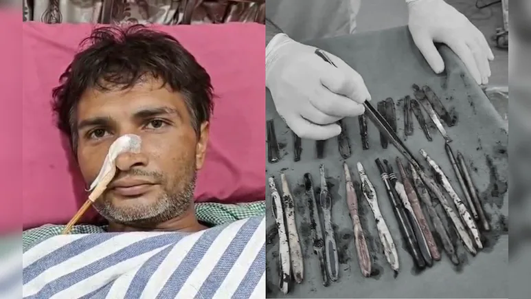29 spoons, 19 toothbrushes, 2 pens pulled out of patient’s stomach